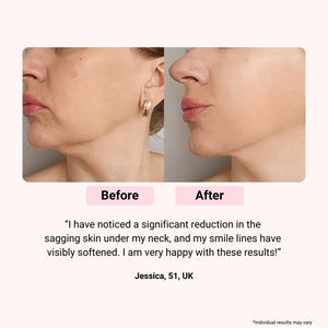 LumieNyxx LED Face Mask