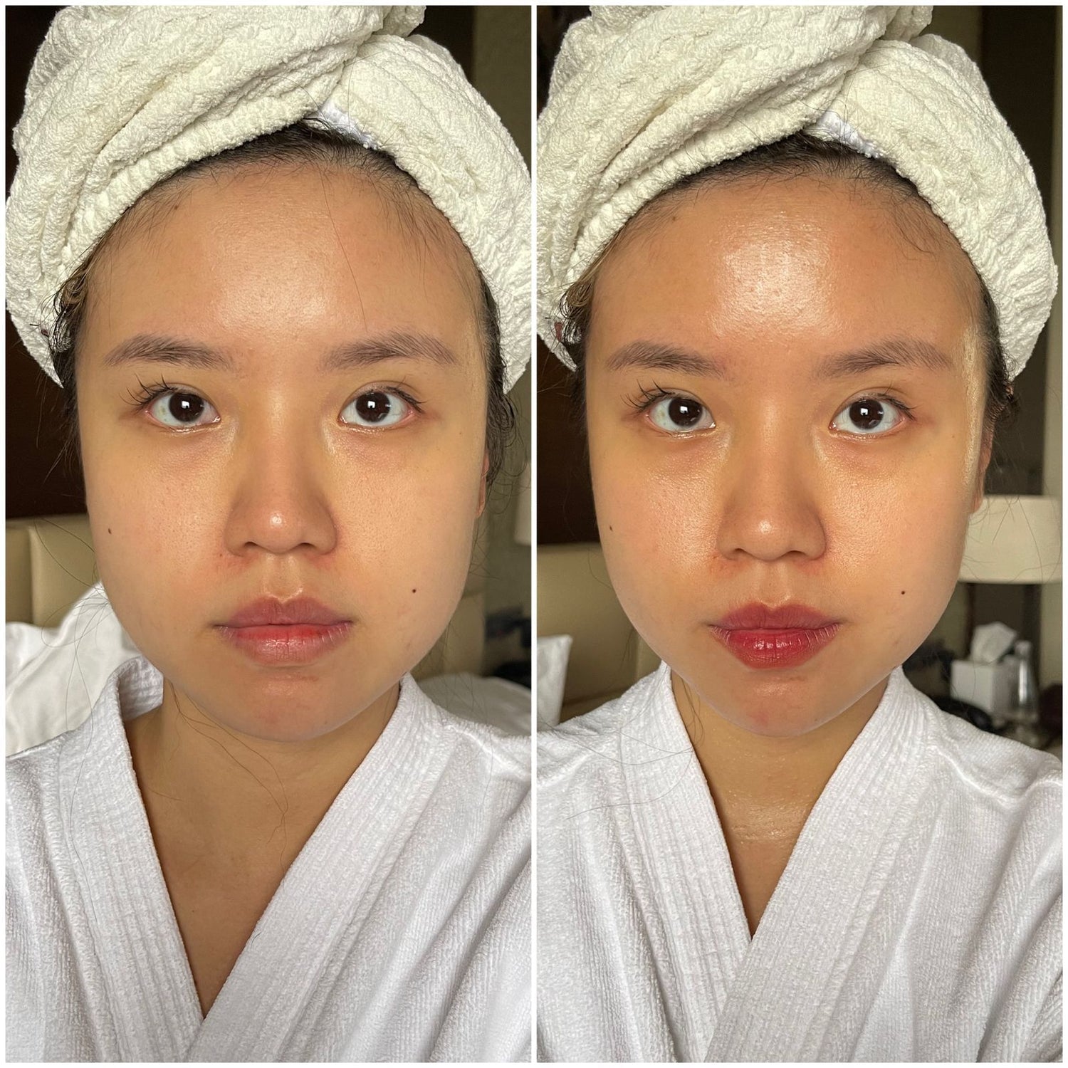 AmpiGlow Facial Toning Device