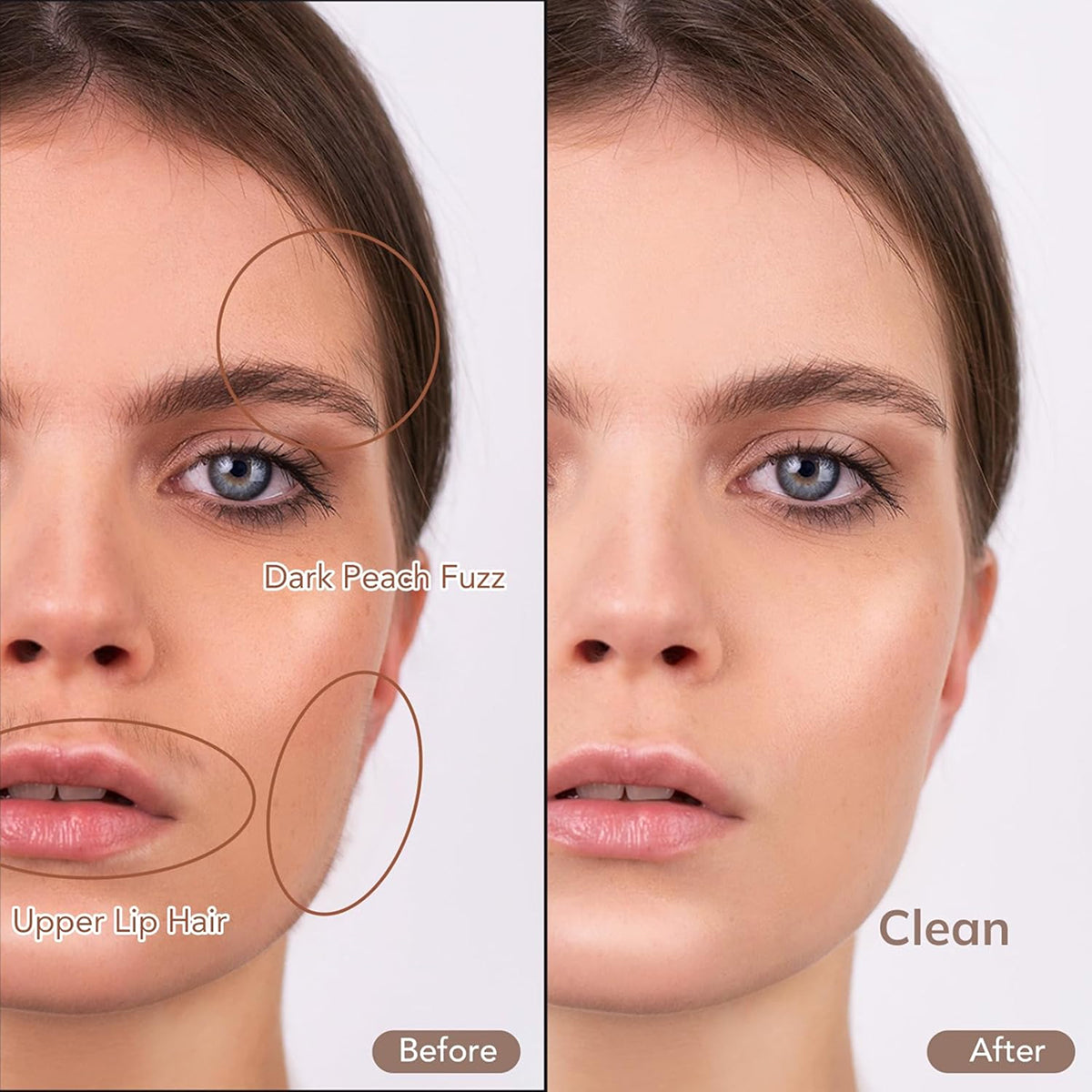 Glassyox Sonic Dermaplaning Device