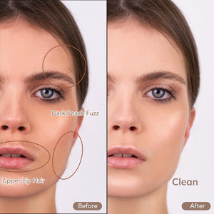 Glassyox Sonic Dermaplaning Device