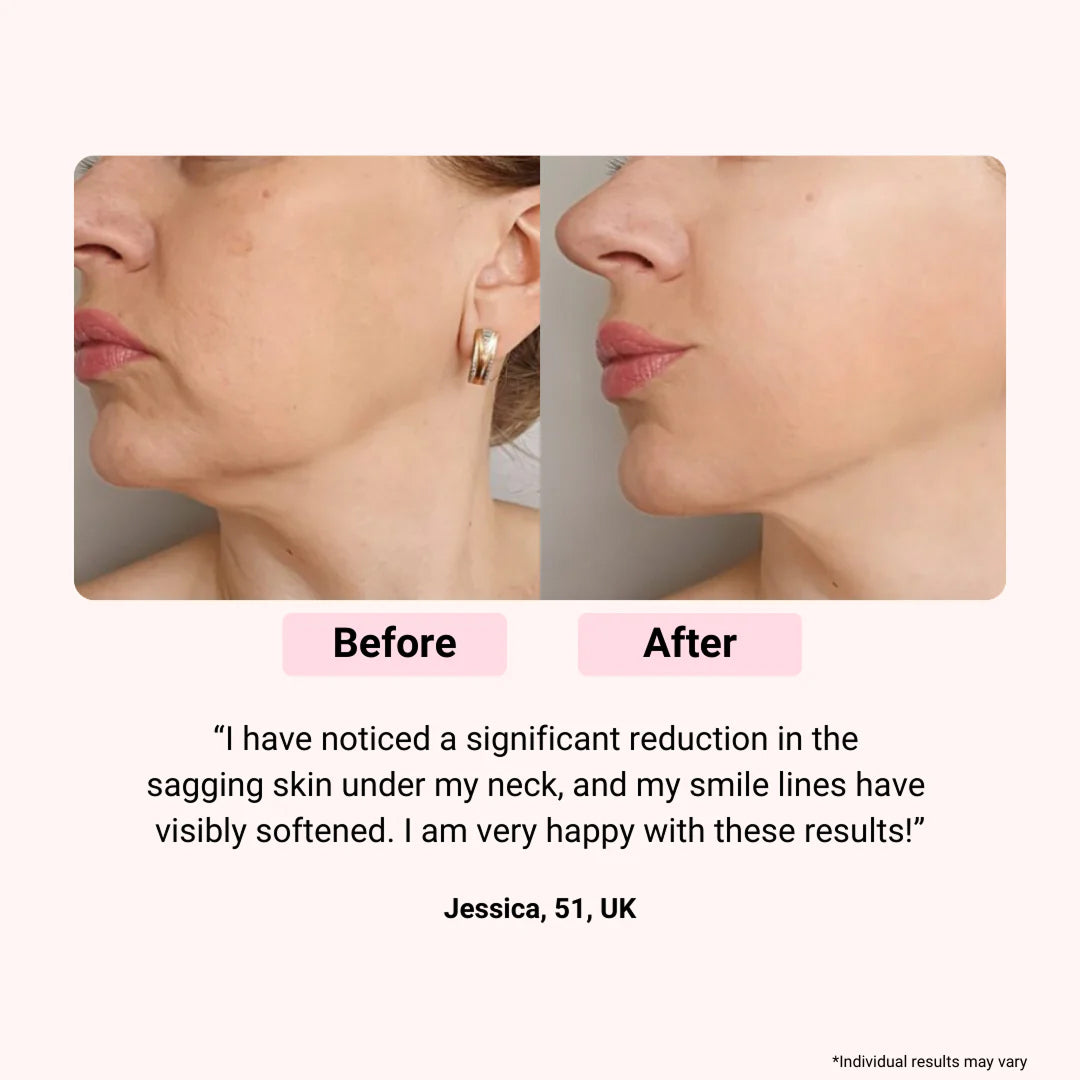 LumieNyxx LED Face Mask